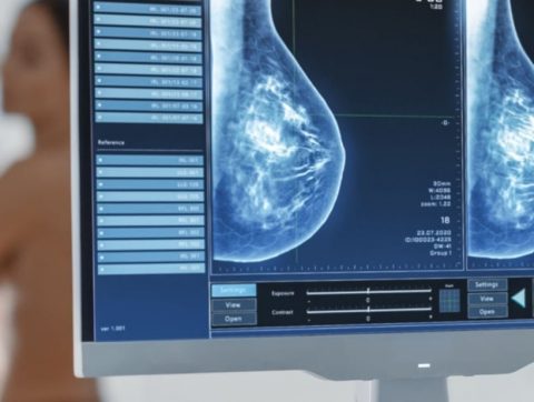 Un nouvel outil québécois en IA pour optimiser la détection des cancers du sein